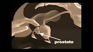 Un jeune farceur naïf est venu voir son vieil ami, et son ami l'a tellement désirée sans ménagement après une longue séparation qu'il a décidé de souffler sa petite amie et devrait être giflé par derrière. Leur copulation insatiable a continué. Le garçon ardent continua de l'empaler méchamment alors qu'elle s'allongeait et gémissait de plaisir. La brune appétissante était une salope insatiable et elle l'aimait beaucoup. La mignonne gémissante continuait à aimer se tenir debout avec le cancer, le femme mure 50 ans mâle bougeait de plus en plus vite, écoutant les soupirs et les gémissements de sa nana.